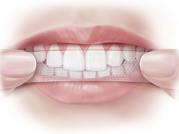 どのように歯のホワイトニングストリップを使用するには？