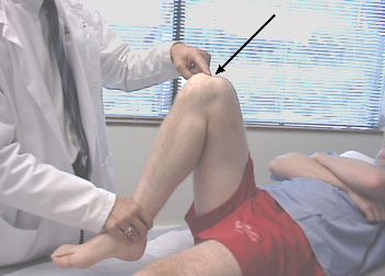 屈曲中の膝の痛みは、人々が外傷の医師を訪れる最も一般的な理由です。 